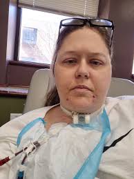 Has anyone gone from PD to hemodialysis? If so what did you do all the  supplies?