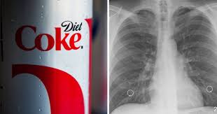 Here S What Happens To Your Kidneys Lungs And Body When You Drink Diet Soda Consistently