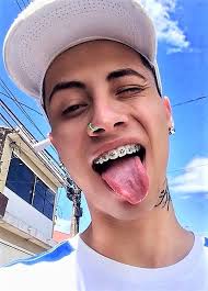 If you still feel like you need to wear makeup, try negotiating with your parents to let you wear light makeup, but make sure you don't go overboard. Pin On Guys In Braces