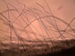 It's a flowering plant that grows in the u.s. Root With Root Hair Cells Phywe De