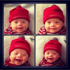 Pin By Mary Hines On Just Because Down Syndrome Baby Down Syndrome Kids Cute Kids