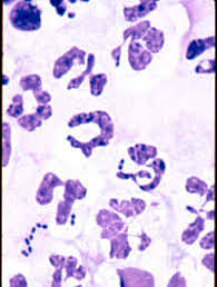 Image result for Intracellular Bacteria