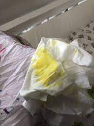 Yellow Vomit Pic Attached February 2018 Babycenter Australia
