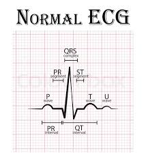 Normal Ecg Electrocardiogram P Stock Vector