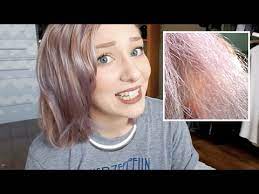 They will help you fix your hair; Part 1 How I Fixed Extremely Damaged Hair Youtube
