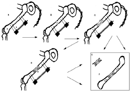 Long bone also illustrates the two surface of bone. Rat Model Of Long Bone Lengthening A Insertion Of An External Download Scientific Diagram