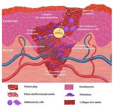 Wound Healing And The Immune System Science In The News