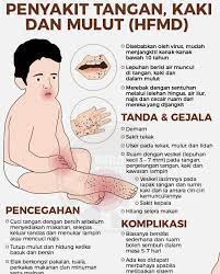 Gambar orang mengangkat tangan kiri dan bunga. Gambar Penyakit Kaki Tangan Dan Mulut Sang Hook