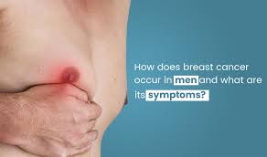 Although, males found to develop this cancer at more advanced stages (3 or 4) in comparison to females. How Does Breast Cancer Occur In Men And What Are Its Symptoms Cancer Healer Center