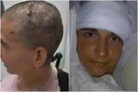 Who is Audrey Crews? Paralysed Woman Writes Her Name After 20 Years with  Neuralink Brain Chip