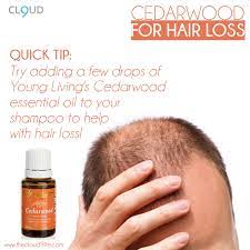 While, in this world, everyone has faced hair loss whether it's the youth or old. Pin On Natural Hair Loss Treatment