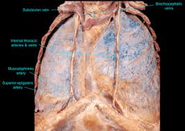 Internal thoracic artery and vein. 2 1 Thorax Ross University Anatomy Instructional Site