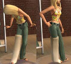 While most causes of death are realistic, there are a few fictional causes of death as well. Mod The Sims Right Leg Plaster Watch Them Limp All Ages Both Sexes