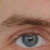 Eyelid twitching or eye twitching (also called blepharospasms) can be embarrassing, inconvenient, and downright annoying. 1