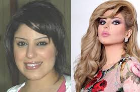 شمس قبل التجميل فضيحة الفنانة شمس الكويتية قبل التجميل شمس قبل عمليات التجميل شمس قبل التعديل شمس اشطح. Ø£Ø¨Ø±Ø² 5 ÙÙ†Ø§Ù†Ø§Øª Ø®Ø¶Ø¹ÙˆØ§ Ù„Ø¹Ù…Ù„ÙŠØ§Øª ØªØ¬Ù…ÙŠÙ„ Ø±Ø¤ÙŠØ§