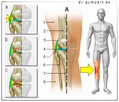 Physiotherapie Humes Kniekehle