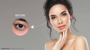 Before & After Eyelash Extensions at Sydney's Best Eyelash Salon