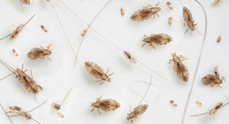 Head lice: What they look like and what to do about them | BabyCenter