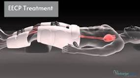 EECP Treatment Cost In India | EECP Therapy In India ...
