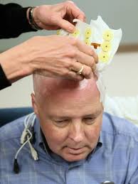 Novel device tries to cap tumors