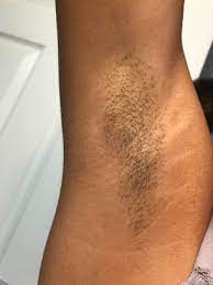 When i signed up for a course of laser treatments for my. 23 Hair Removal Products That People Actually Swear By