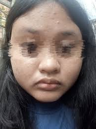 Please anything that can help my skin PLEASE