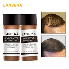 A range of indian and natural hair care products often suggested in tips for how to care for hair. Hair Putty Which Oil Is Good For Hair Herbs For Hair Growth Indian Hair Oil Hair Growth Formula Shampoo For Thinning Hair Hair Growth Products Emporiaz