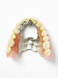 Maybe you would like to learn more about one of these? Metal Dentures Available In Kingston London Everyday 9am 10pm