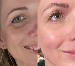 Let's welcome our newest members: Irene Hadley, Arinn Nyberg and Lisa  Henderson! We're so excited to have you here! This is your safe space for  all things health, wellness, and balance. Whether