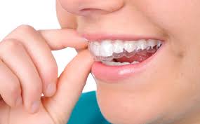 Ask your dentist for new retainers. Best Practices For Keeping My Retainer Clean