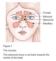 They're not usually serious, but they can keep growing and block your nose if not treated. Endoscopic Sinus Surgery The Holly Private Hospital Essex