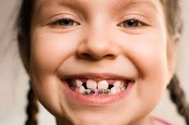 That's not all the program. What Age Is The Best To Get Braces And What Type