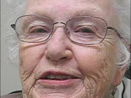 Strabismus in the Elderly