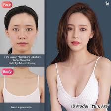Id Plastic Surgery Hospital Idhospitalkorea Instagram Photos And Videos Search Tags Surgery Medici Plastic Surgery Cosmetic Surgery Korean Plastic Surgery