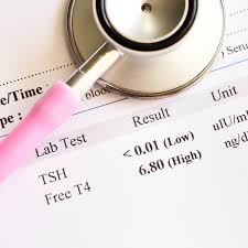 What happens during a blood test? How To Interpret Blood Test Results