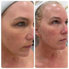 Kalena Gilbert Meyers added a new...