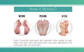 This is a new concept to most people, but, when you consider the reasons why after you exfoliate your feet, rinse clean, then dry and apply a thick layer of foot cream. Amazon Com Foot Chemistry Foot Peel Mask Soft Baby Feet In 1 Week Natural Moisturizing Dry Foot Peeling Exfoliant Dead Skin Remover Callous Cracked Heel Treatment