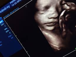 Precious to see your babies side by side. Prenatal Peek Myrtle Beach 3d 4d Ultrasound