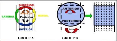 You may need more surgery. Influence Of Breast Cancer Margin Assessment Method On The Rates Of Positive Margins And Residual Carcinoma The American Journal Of Surgery