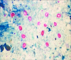 The assessment of the consumer's exposure to cryptosporidium danger is crucial for public health. Cryptosporidium Parvum Round And Cryptosporidium Andersoni Oval Download Scientific Diagram