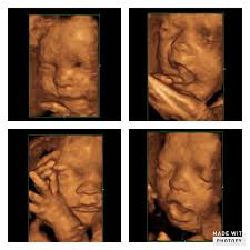 💗💗💗 4D at 28 weeks