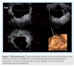 Role And Potential Of Modern Ultrasound In Pediatric Abdominal Imaging