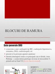 Exista mai multe tipuri de bloc de ramura stanga, fiecare caracterizat prin propriul mecanism de disfunctie. Ekg Brd Brs Iv