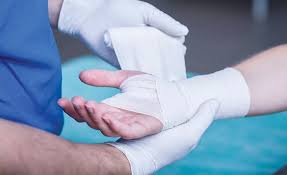 Image result for Hand Injury