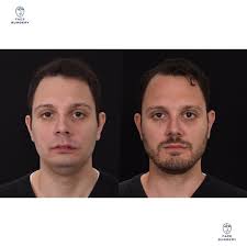 Face Surgery (@face_surgery_parma) • Instagram photos and videos