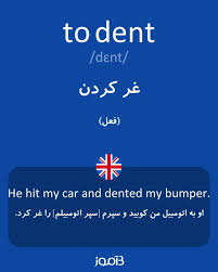 نتیجه جستجوی لغت [dent] در گوگل