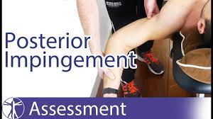 Posterior Impingement Sign Internal Shoulder Impingement Youtube