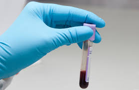 How Accurate Are Fourth Generation Combination Tests For Hiv Diagnosis Aidsmap