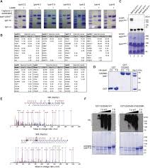 We did not find results for: Pathogenic Ubiquitination Of Gsdmb Inhibits Nk Cell Bactericidal Functions Sciencedirect