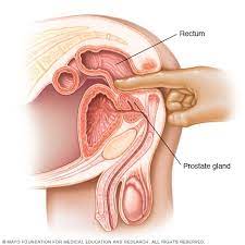 Psa is found in semen, with a small amount in the blood. Prostate Cancer Diagnosis And Treatment Mayo Clinic